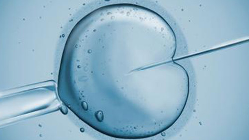 借卵试管婴儿期间获取卵子的程序是穿刺取卵