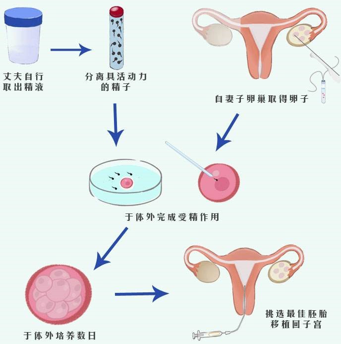 还在试管代怀的精子卵子来源